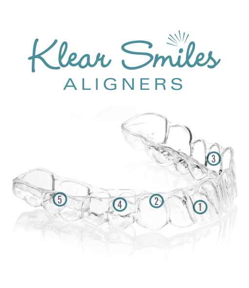 Klear Smiles Aligners